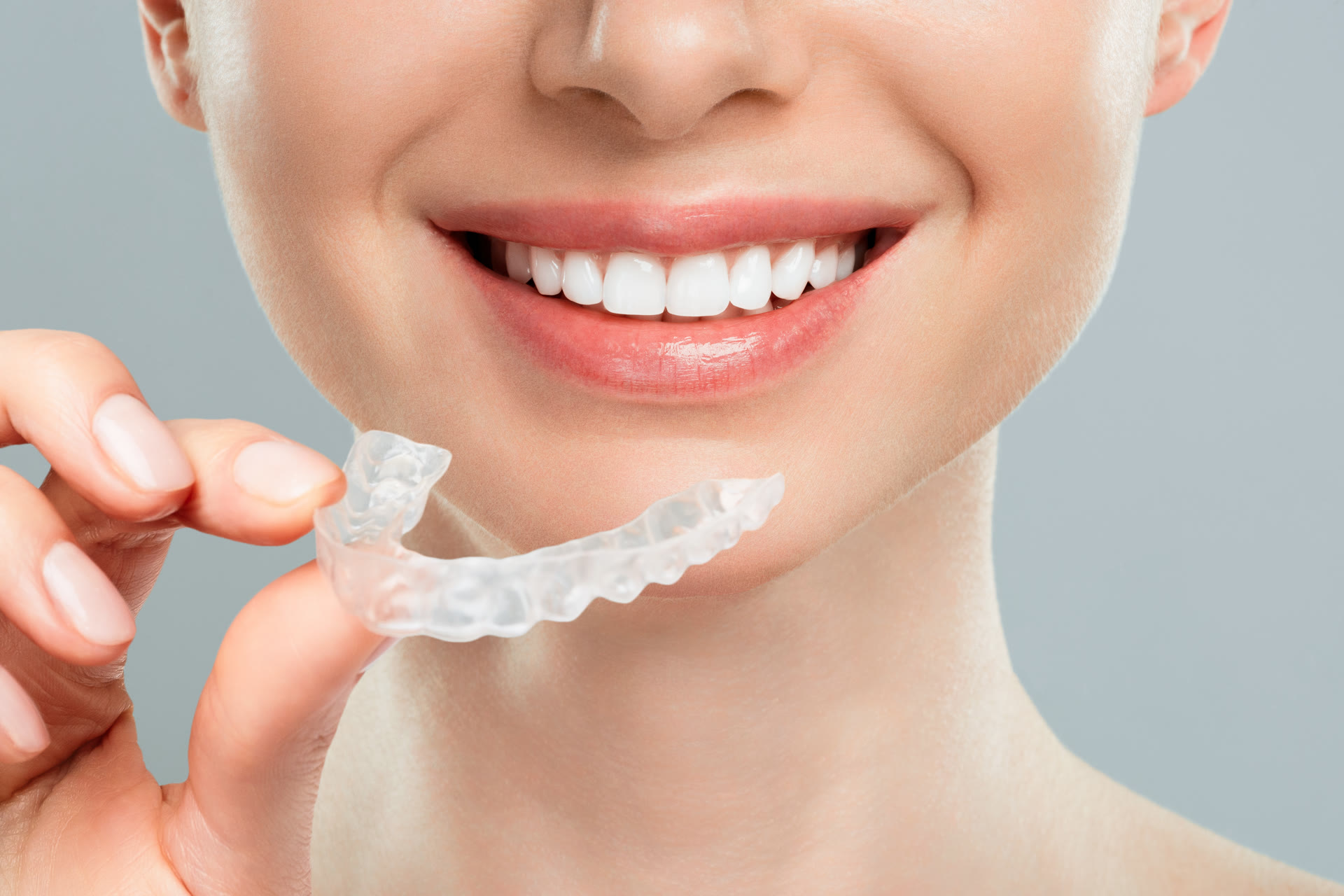 Invisalign Clear Aligners Irvine CA